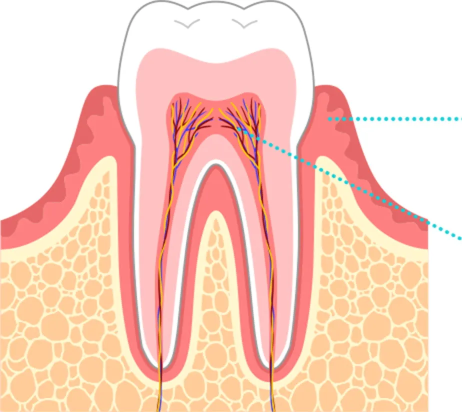 歯の土台の修復