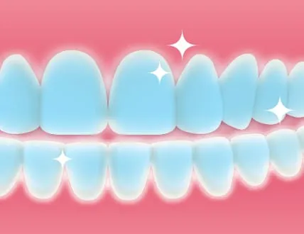 歯の汚れを予防する フッ素塗布