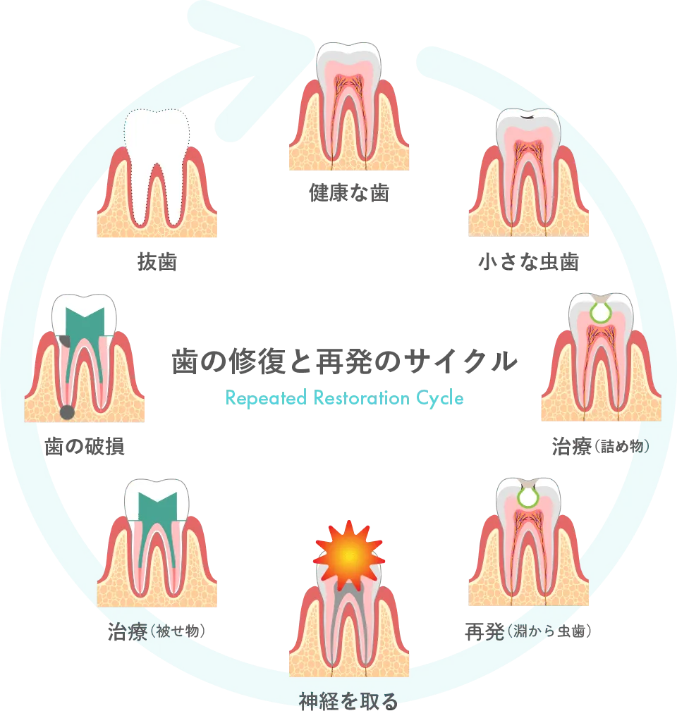 口腔診断 歯・神経の温存と咬み合わせを治す