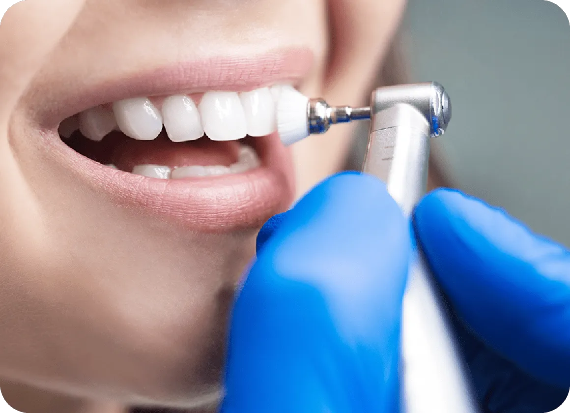 歯科衛生士による専門治療