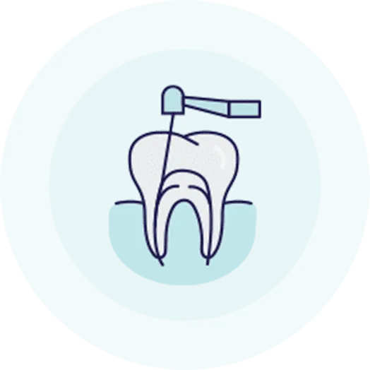 歯内療法 Endodontic